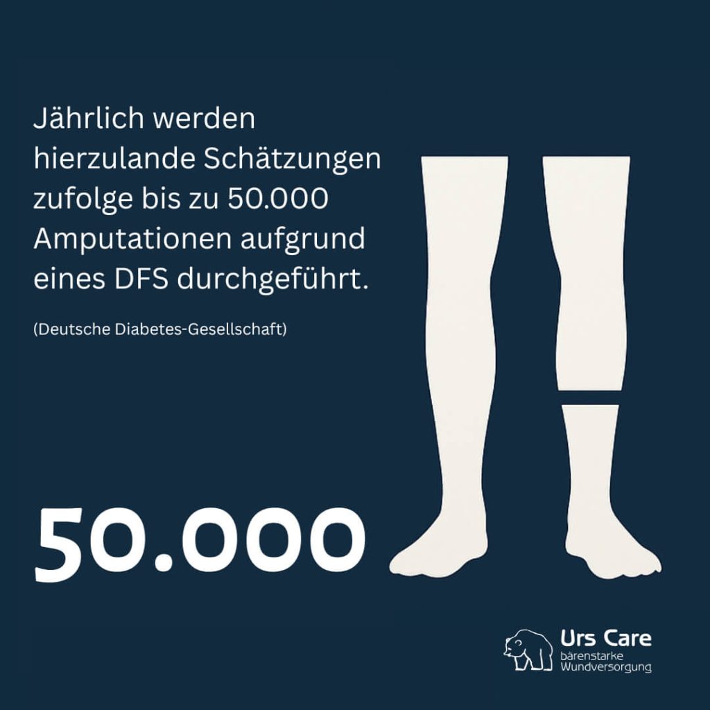 Diabetischer Fuß Wundversorgung Anteil Diabetischer Fuß Wundversorgung Amputationen